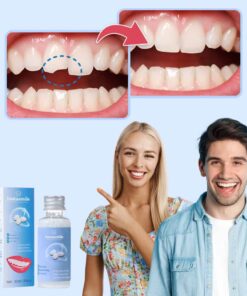 KIT DE REPARACIÓN DE DIENTES INSTASMILE